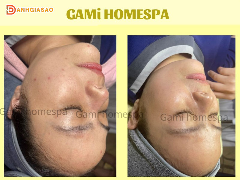 gami-homespa-dia-chi-spa-tri-mun-tphcm-uy-tin-danhgiasao