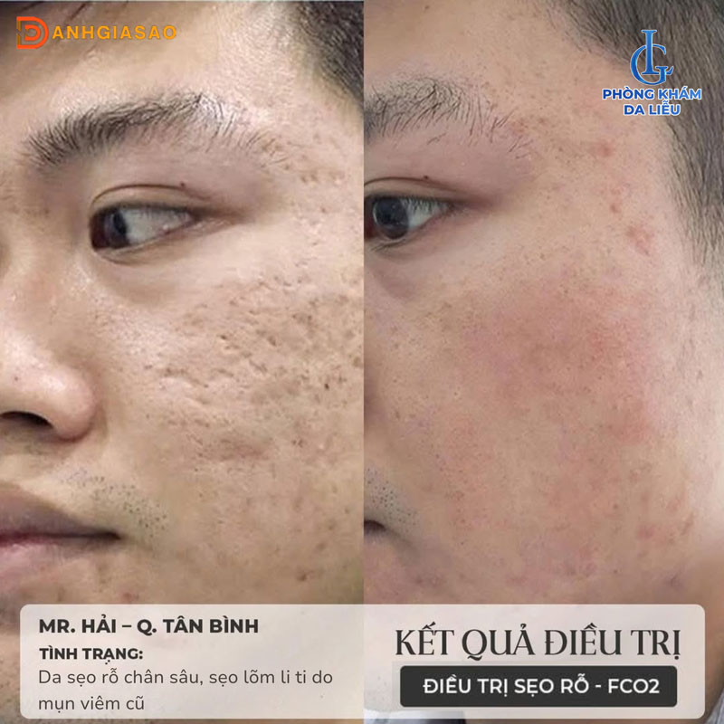 Review-phong-kham-da-lieu-lg-tri-seo-ro-co-tot-khong-1-danhgiasao